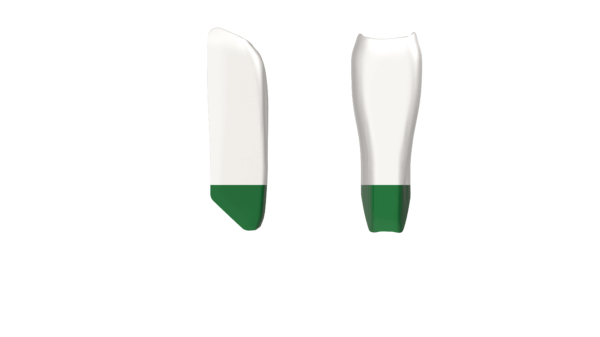 Black Triangle (BT) Kit - Image 10