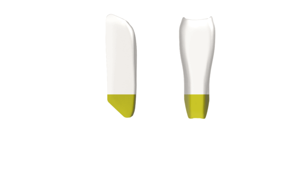 Black Triangle (BT) Kit - Image 8