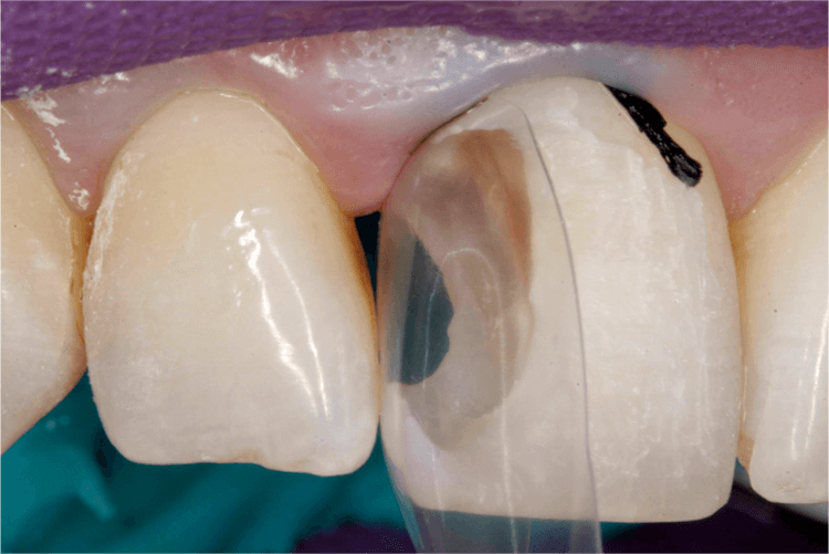 4Day Full Bioclear Method Core Level 1.0, 2.0, 3.0, & 4.0 Bioclear