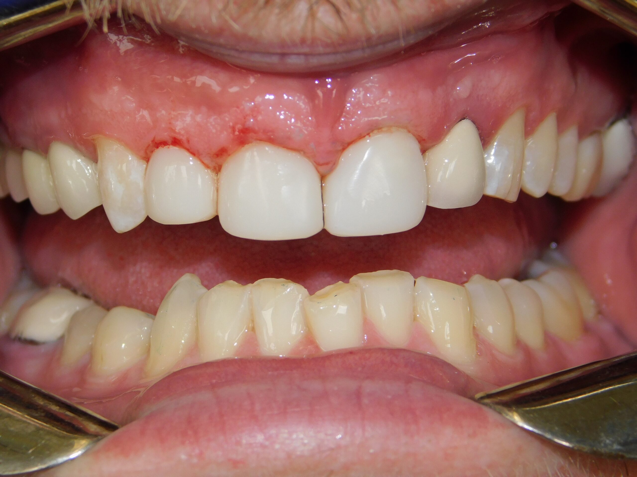 Bioclear