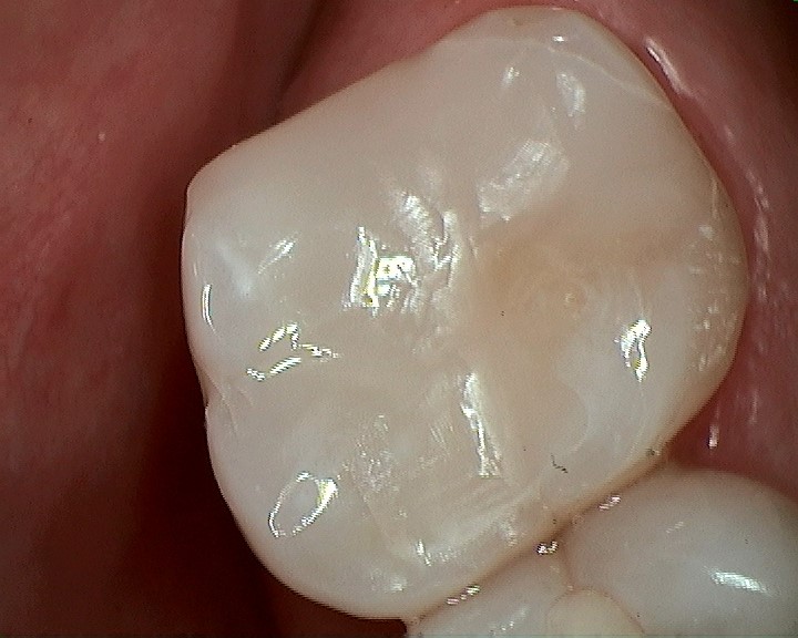 Bioclear