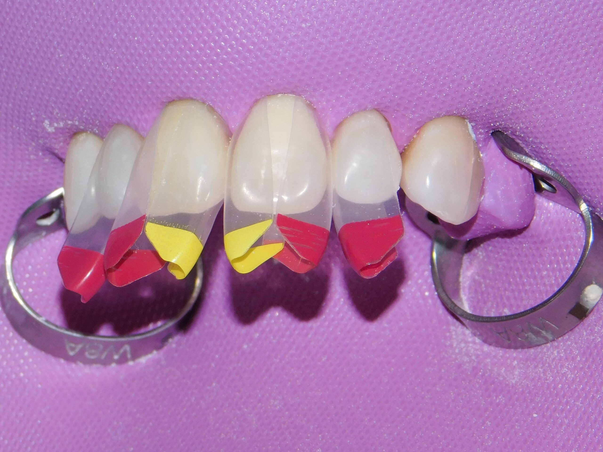 Bioclear