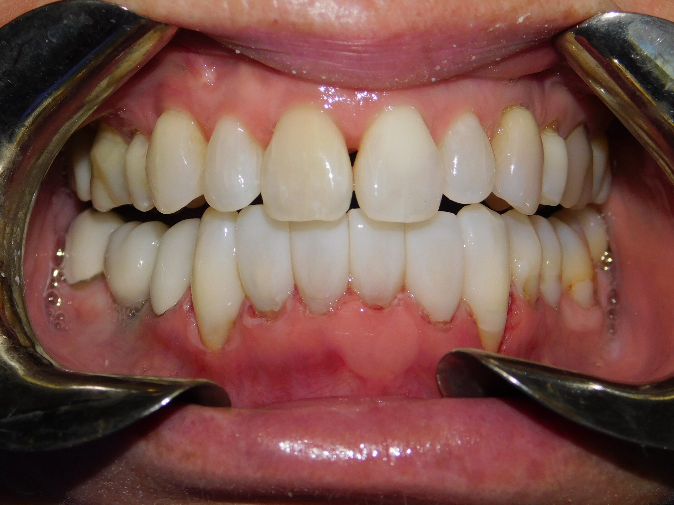 Bioclear