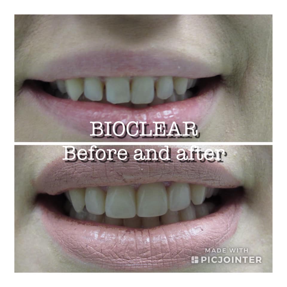 Bioclear