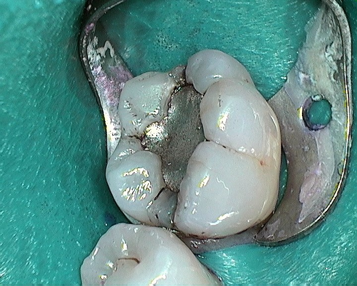 Bioclear