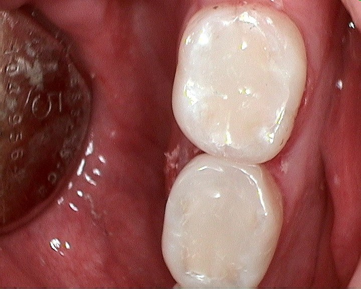 Bioclear
