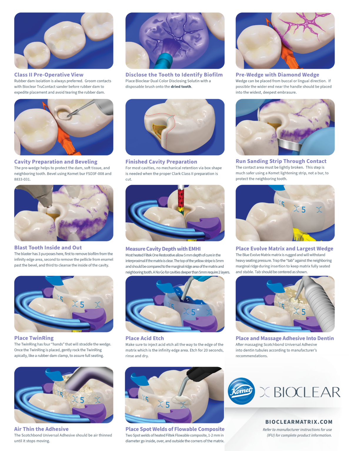 Bioclear Class II Bioclear