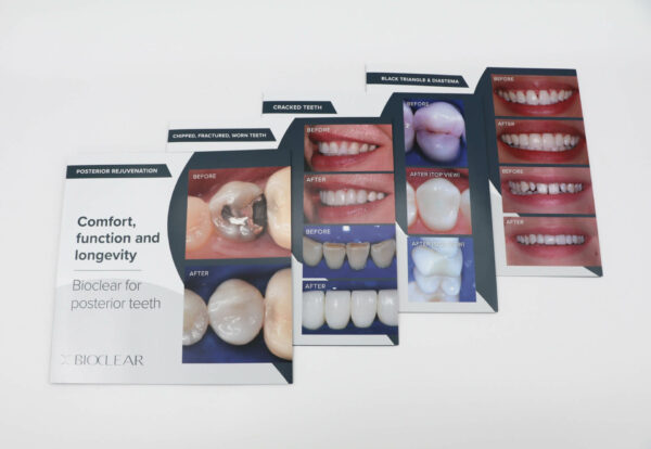 Patient Brochures